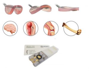 BiogelX BiogelX